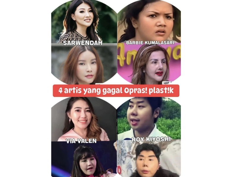 ciri operasi plastik gagal